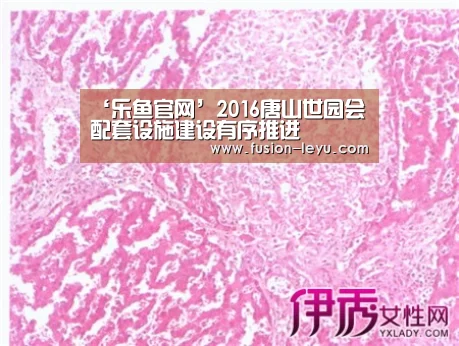 ‘乐鱼官网’2016唐山世园会配套设施建设有序推进(图1) 乐鱼
